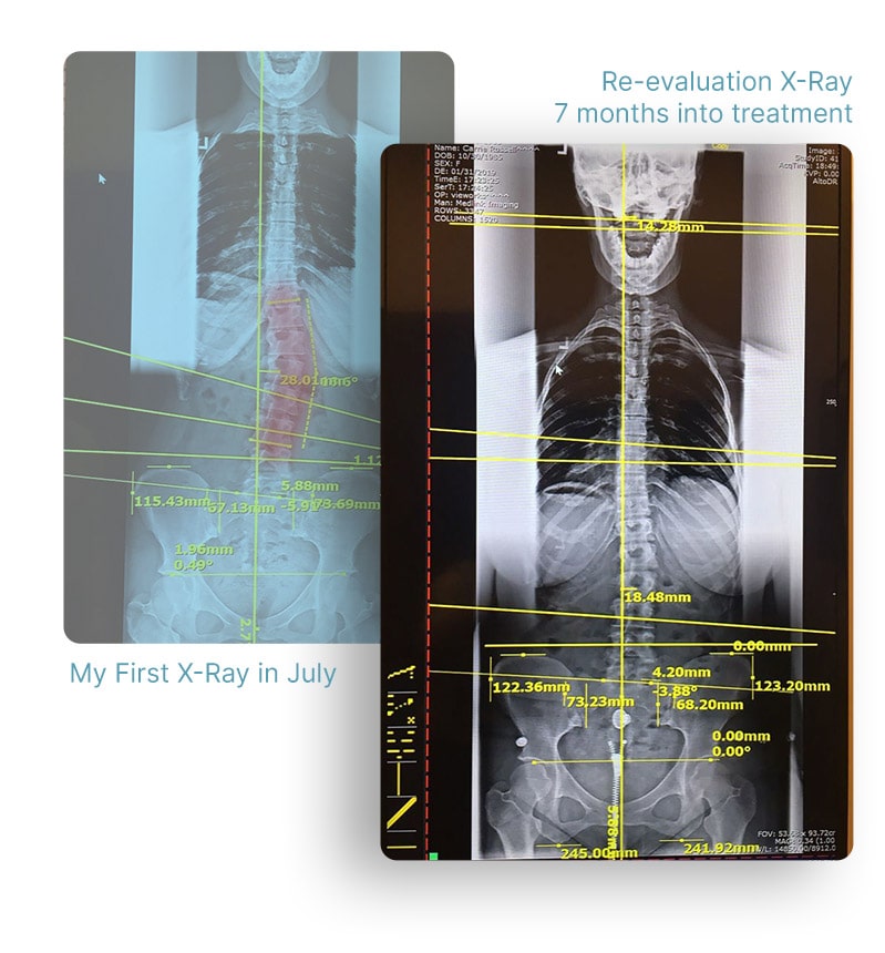 xray-min